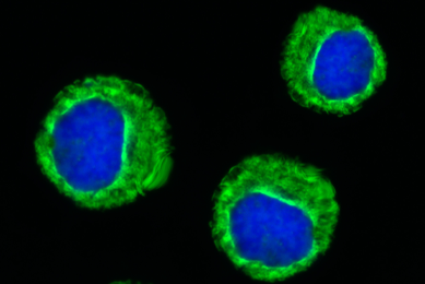 Fluorescent blue and green spheres of leukemic cells.