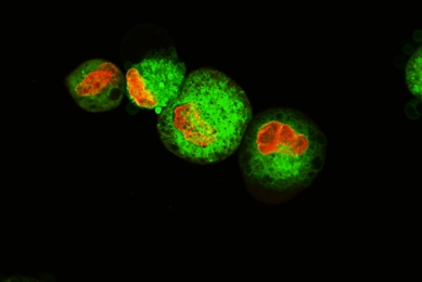 CAR-T cells, CAR-Target, CD19, CD20, HER2