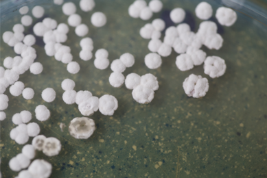 Small, white, fluffy balls of bacteria.