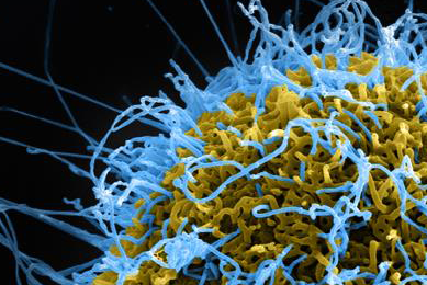 Tangled ball of blue and yellow ebola virus tendrils.