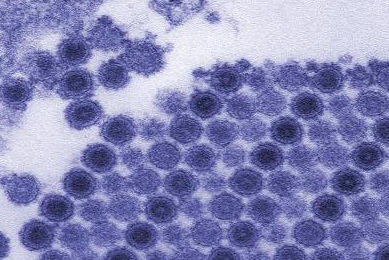 Collection of round, blue and black circles of chikungunya virus.