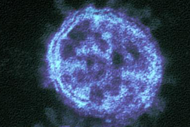 Grainy, blue and black translucent spheres of Middle East respiratory syndrome coronavirus.