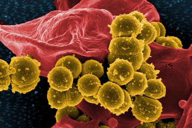 Red swaths of Methicillin-resistant Staphylococcus aureus with small gold growths.