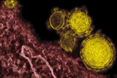 Grainy, pink and yellow spheres of Middle East respiratory syndrome coronavirus.