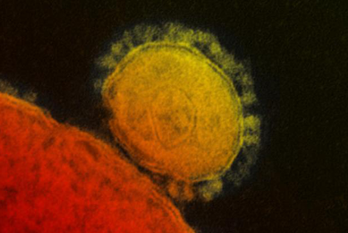 Grainy, large red and yellow spheres of Middle East respiratory syndrome coronavirus.