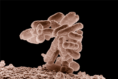 Brown and white, rod-shaped Escherichia coli bacteria cluster.