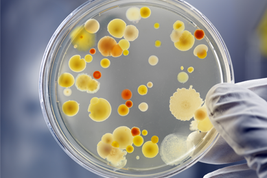 White-gloved fingers holding a petri dish containing yellow, orange, and red spheres of bacteria.