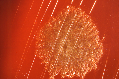 an orange, sphere of Clostridium bacteria on a flat surface with lines dividing sections of it.