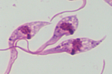 Pink Trypanosoma cruzi parasites with tails