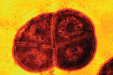 Grainy red and black Deinococcus radiodurans extremophilic bacterium.