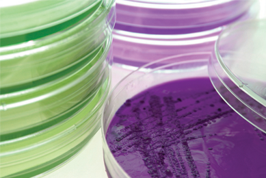 Petri dishes containing purple and green media.