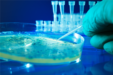 Gloved hand holding mini pipette over petri dish containing bacteria colonies