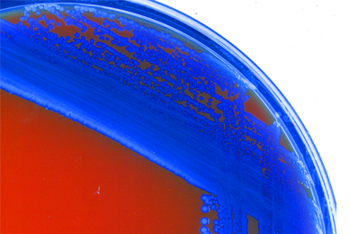 Blue bacteria cultures growing on red media in petri dish.