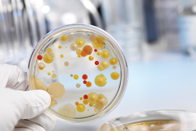 Gloved hand holding petri dish containing red and yellow bacteria cultures.