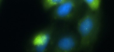 Faded blue and green exosomes spheres on a black background.