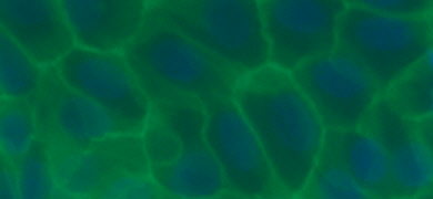 Green and blue connecting cells.