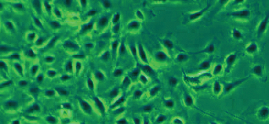 Fluorescent green and black primary microvascular endothelial cells.