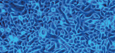 Small, fluorescent blue and white prostate cells.
