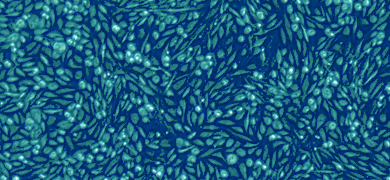 Small, fluorescent blue-green epithelial cells.