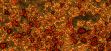 Orange, red, and black adipose-derived mesenchymal stem cells.