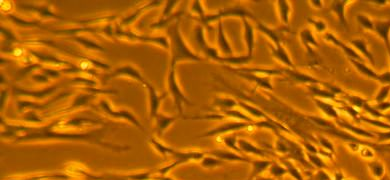 Thin, rod-like, fluorescent orange and black fibroblast cells.