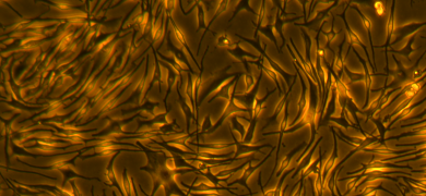 Small, long, thin, yellow and brown melanocyte cells.