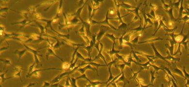 Fluorescent burnt-orange and gold, web-like cardiomyocyte cells.