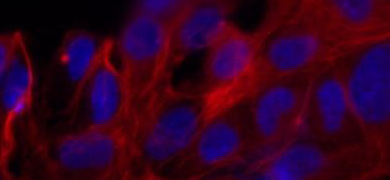 Red and blue phalloidin human umbilical vein endothelial cells.