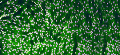 Small, round, purple and green uterine smooth muscle cells.