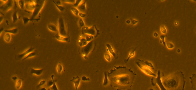 Orange and brown small airway epithelial cells.