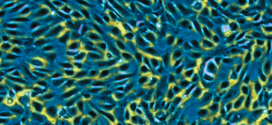 Small, fluorescent yellow, blue, and black human umbilibal vein endothelial cells.