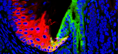 Blue green and red barretts esophagus cells.