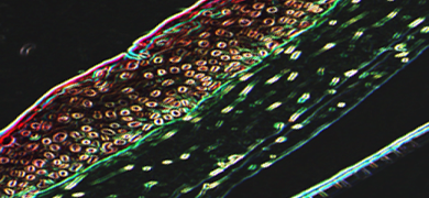 Fluorescent red, brown and green human telomerase reverse transcriptase, skin cells.