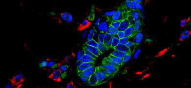 Donut-shaped, fluorescent blue and green, mouse, mammary cells.