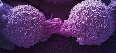 Purple lung cancer cells.