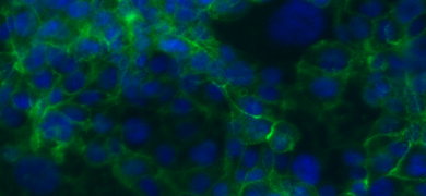Fluorescent blue and green colon cells.