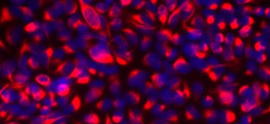 Fluorescent red and blue, red, and black colon cells.