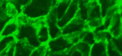 Fluorescent lime green web of  renal proximal tubular epithelial cells.