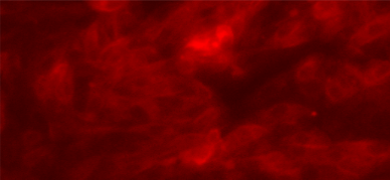 Red renal proximal tubular epithelial cells.