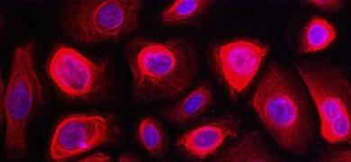 Spherical, fluorescent pink and purple bronchial epithelial cells.