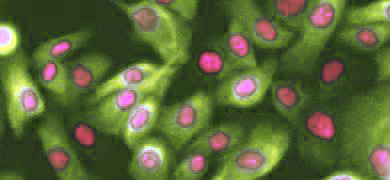 Pink and green mammary epithelial cells.
