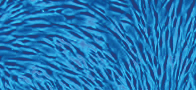 Long, strands of fluorescent blue skin dermal fibroblast cells.