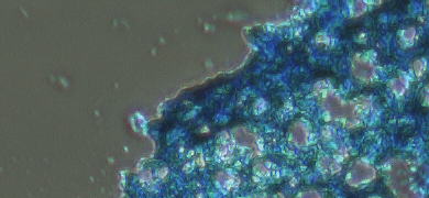 Cluster of blue, porous mesenchymal stem cells.