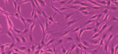 Strands of fluorescent pink  human mesenchymal stem cells.