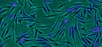 Long, thin, rod-shaped, fluorescent green and blue melanocyte cells.