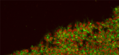 Green and red embryonic-like induced pluripotent stem cells.