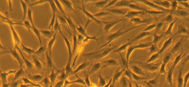Long, fluorescent orange and brown embryonic human mesenchymal stem cells.