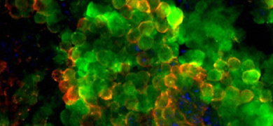 Round, blurred, fluorescent lime green, orange, and blue, mouse embryo stem cells.