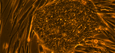 Long, strands and small spheres of fluorescent orange and brown induced pluripotent stem cells.
