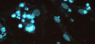 Blue m-fermentens mycoplasma cells.